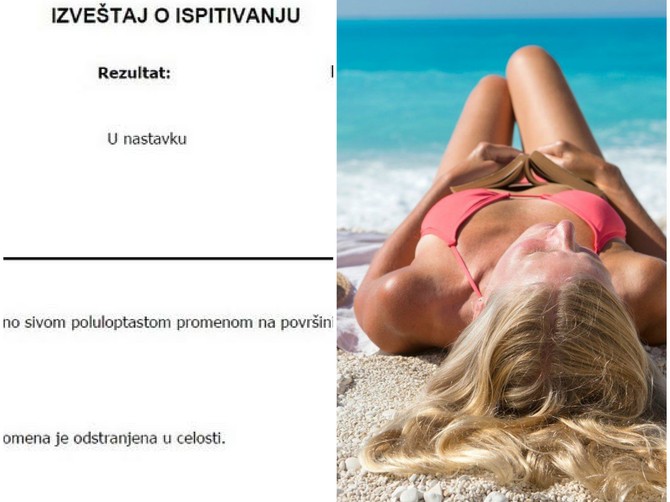 Za mene više nema sunčanja