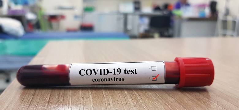 Ponad 109 tys. przypadków COVID-19 na świecie. 3,8 tys. zgonów [NOWE DANE]
