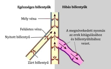 vénák, érszűkület, értágulat