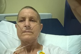 Saru su ubeđivali da je u menopauzi, a onda dobila agresivan oblik raka