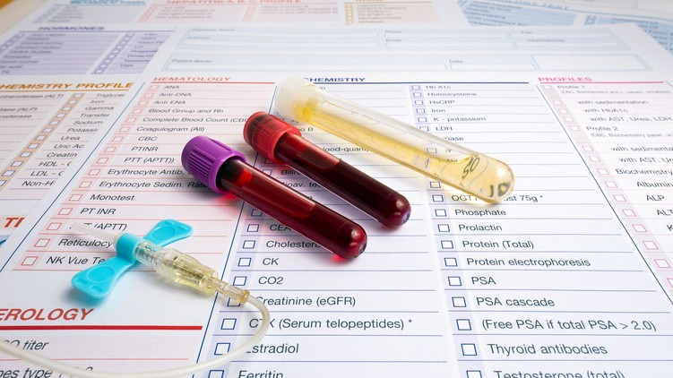 vérkép jelentése biomarker leleten onkológia
