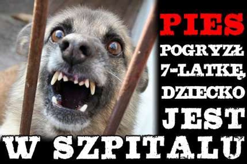 Pies pogryzł 7-latkę, dziecko jest w szpitalu