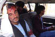 Ranny Afgańczyk, który próbował się przedostać na lotnisko w Kabulu.