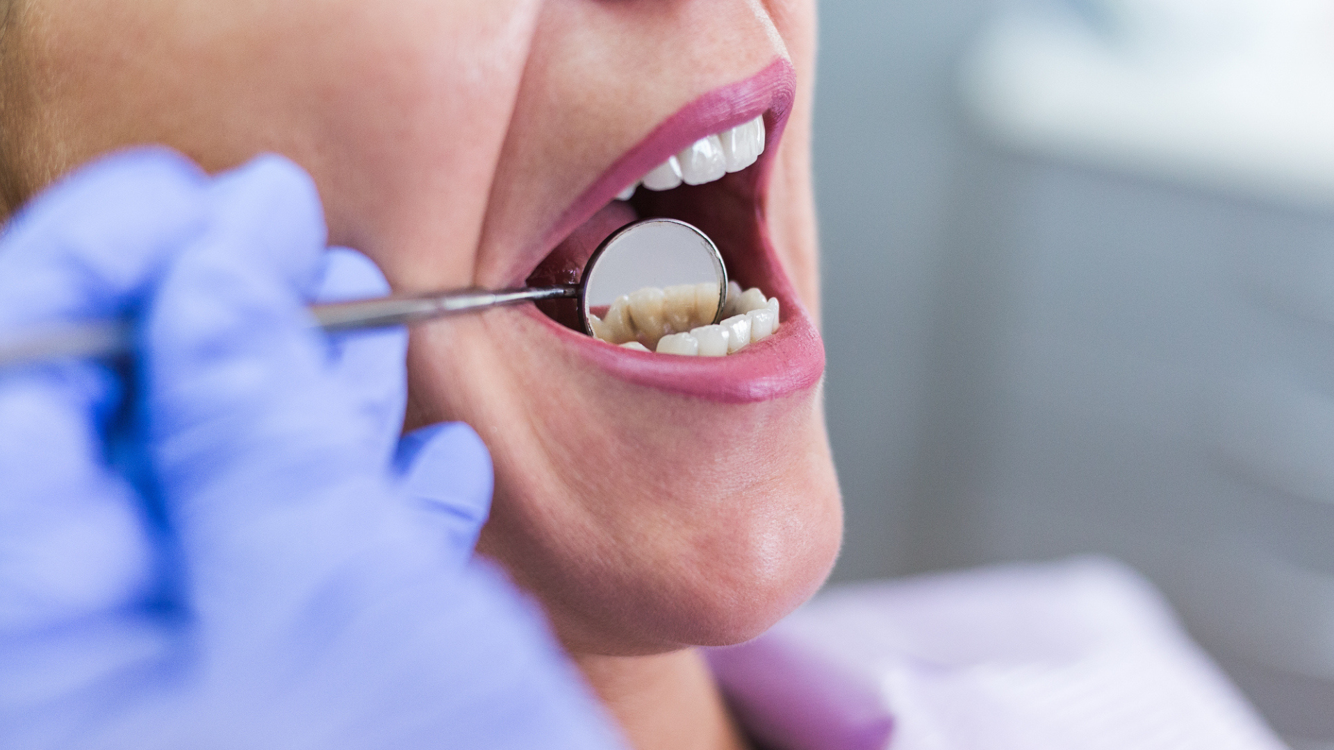 MZ eviduje prípady nelegálnej zubárskej praxe, hľadá legislatívne riešenia. (ilustračné foto). 