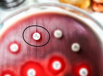 Elkeserítő eredmények: a jövő antibiotikumai hatástalanok lesznek a baktériumokkal szemben