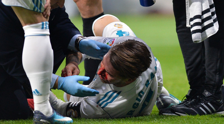 Sergio Ramos törött orra nem ért lapot a játékvezetőnél /Fotó: AFP