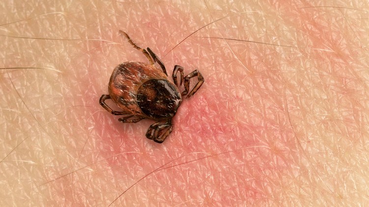 lyme-kór, kullancs, csípés, piros folt tünetek