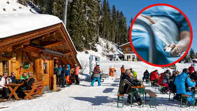Brytyjczyk pojechał na narty do Austrii. Stracił kawałek nosa