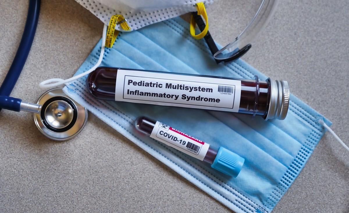 Pediatric,Multisystem,Inflammatory,Syndrome.,Kawasaki,Disease,Symptoms.