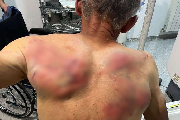 "OVO SU BEZBEDNOSNE PRETNJE" Vujinović o brutalnom napadu na Raškoviča na KIM: Nije izolovani incident, Srbi na KiM ozbiljno ugroženi