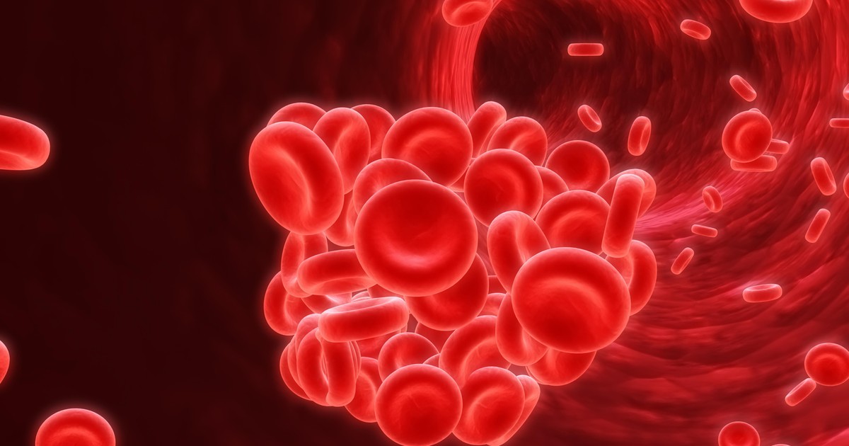 Zakrzepica - przyczyny, leczenie i profilaktyka. Sześć najczęstszych objawów zakrzepicy [WYJAŚNIAMY]