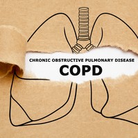 Így változtassa meg az étkezési szokásait, ha COPD-je van