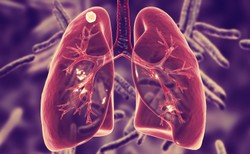 "Najbardziej śmiercionośna choroba" przenosi się także przez oddech. O tym wcześniej nie wiedzieliśmy