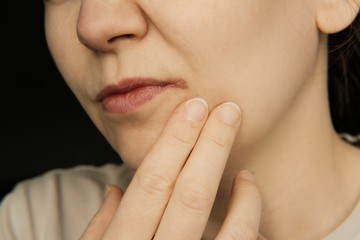 Berepedezett szájzug ellen ezek a leghatásosabb házi gyógymódok