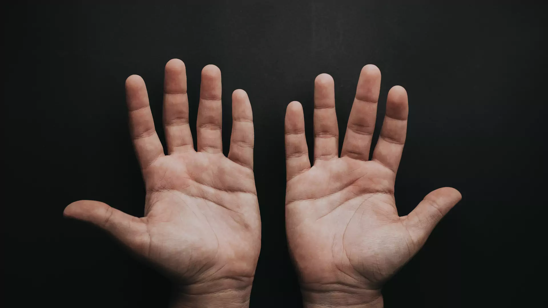Osiem rzeczy, jakie o Twoim zdrowiu mogą mówić Twoje dłonie