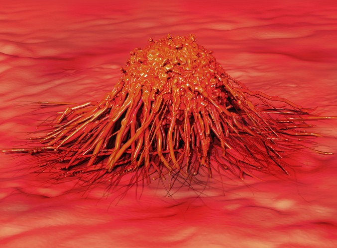 5. Chroni przed rakiem