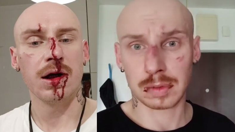 Jacek Szawioła z programu "Gogglebox. Przed telewizorem" został pobity