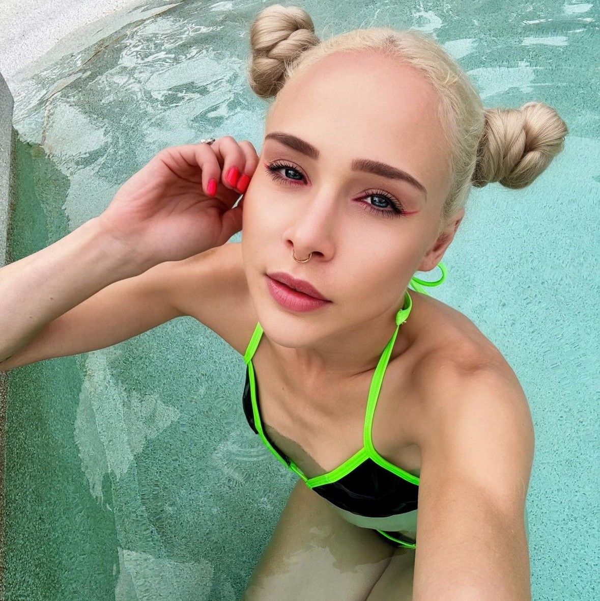 Modelku trápia bolestivé infekcie.