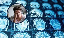 Dlaczego boli głowa, skoro mózg nie może boleć? [WYJAŚNIAMY]