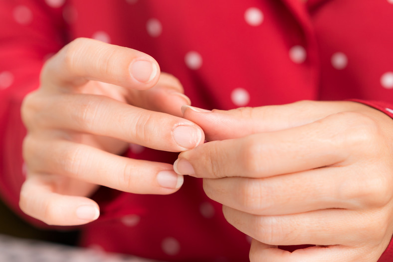Pękające skórki przy paznokciach dużo mówią o twoim zdrowiu
