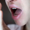 Hronična upala usne duplje može da ugrozi žensku plodnost pokretanjem sistemskog imunološkog odgovora koji utiče na jajnike