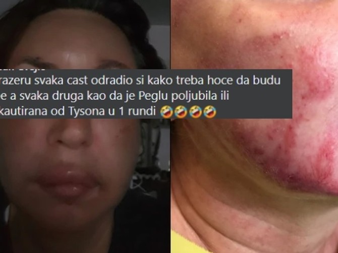 Komentari na društvenim mrežama