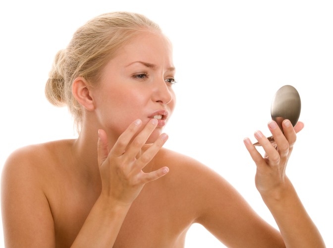 1. Pękające kąciki ust