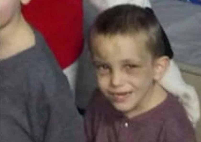 Przerażające zdjęcia obrażeń zabitego 5-latka. Zrobili mu to najbliżsi 