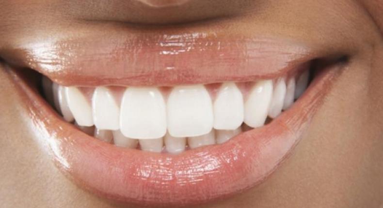 Woman with white teeth