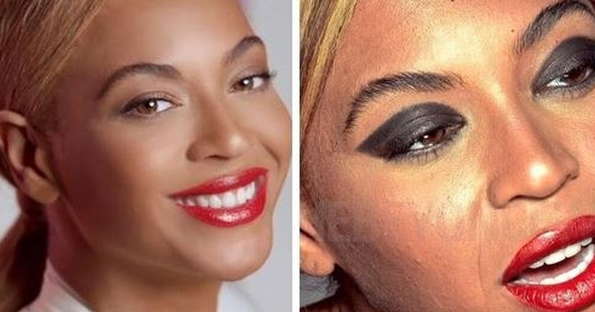 5 celebrities with embarrassing acne Pulse Ghana