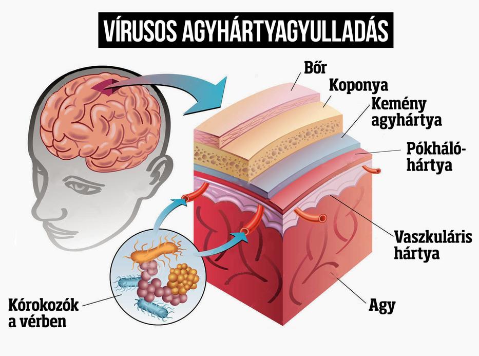 Szovjet agyhártya