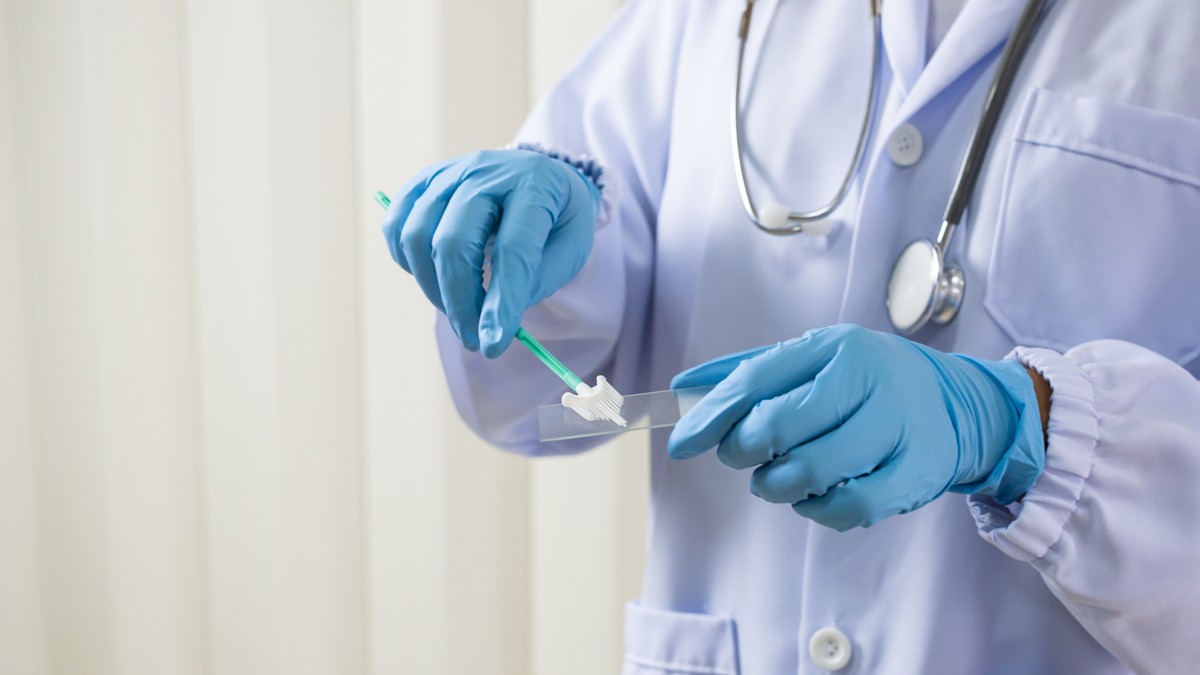 Kako se radi HPV genotipizacija i šta otkrivaju rezultati ovog testa - Blic