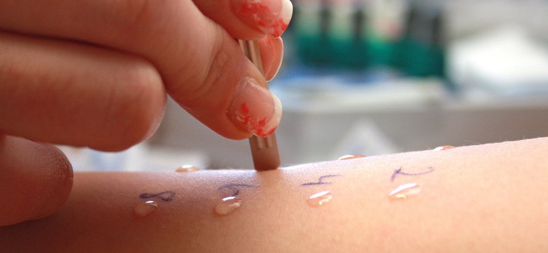 Przełom w wykrywaniu alergii. Polacy stworzyli system sztucznej inteligencji SkinLogic