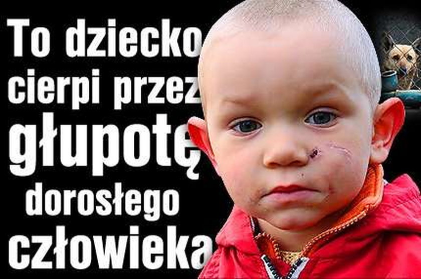 To dziecko cierpi przez niewyobrażalną głupotę dorosłych