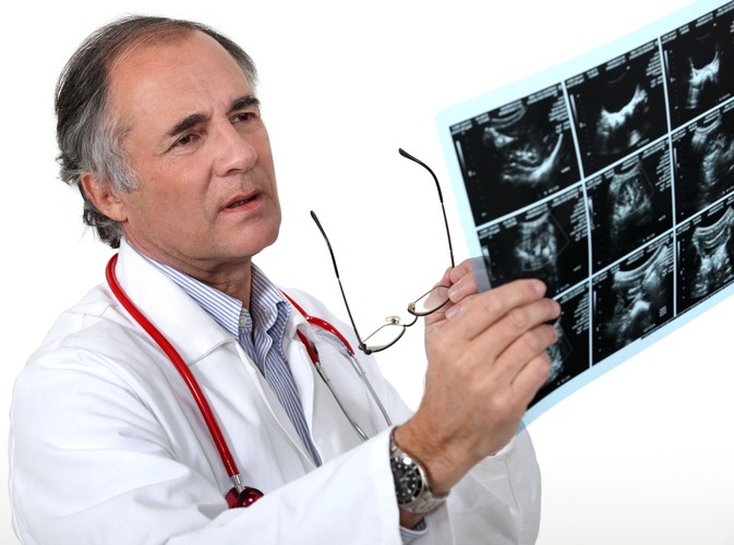 Jak diagnozuje się stwardnienie zanikowe boczne?