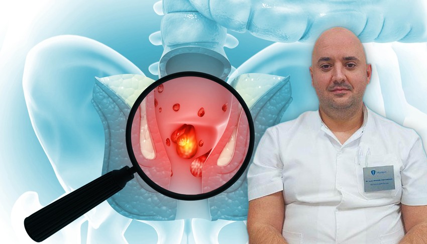 U kliničkoj praksi, lekarsku pomoć najčešće traže ljudi koji, između ostalog, primete krv u stolici i koju pogrešno pripisuju hemoroidima 
