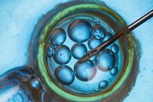 Kobieta chce in vitro, a mężczyzna nie. Czy w takiej sytuacji można zablokować przeniesienie zarodka?