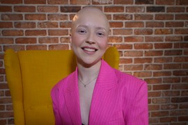 "Mislila sam da ću UMRETI SA 20 GODINA": Emilija iz Pančeva izgubila je kosu i prijatelje zbog RAKA, ali su njen verenik i porodica OBRIJALI GLAVE da joj pokažu da NIJE SAMA!