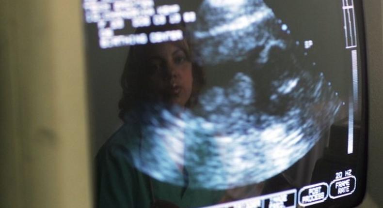 Top court rejects North Carolina abortion ultrasound case