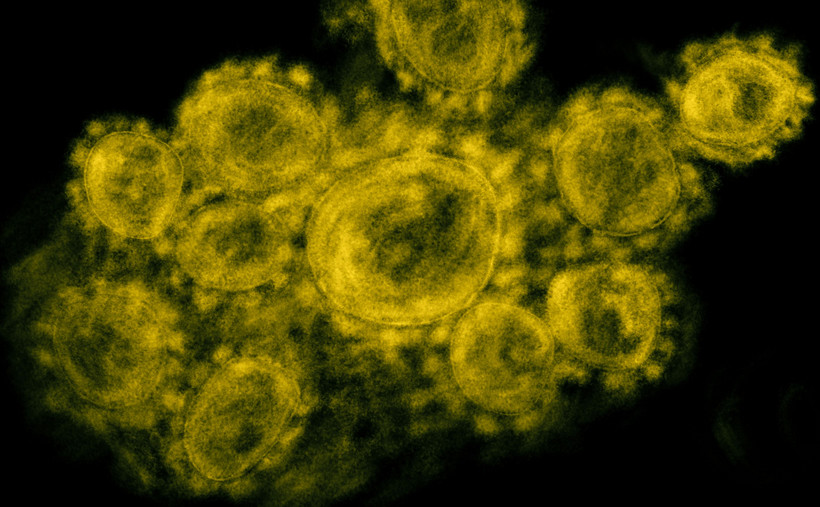 Koronawirus pod mikroskopem