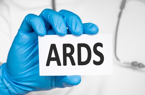 Akut légúti distressz szindróma (ARDS)
