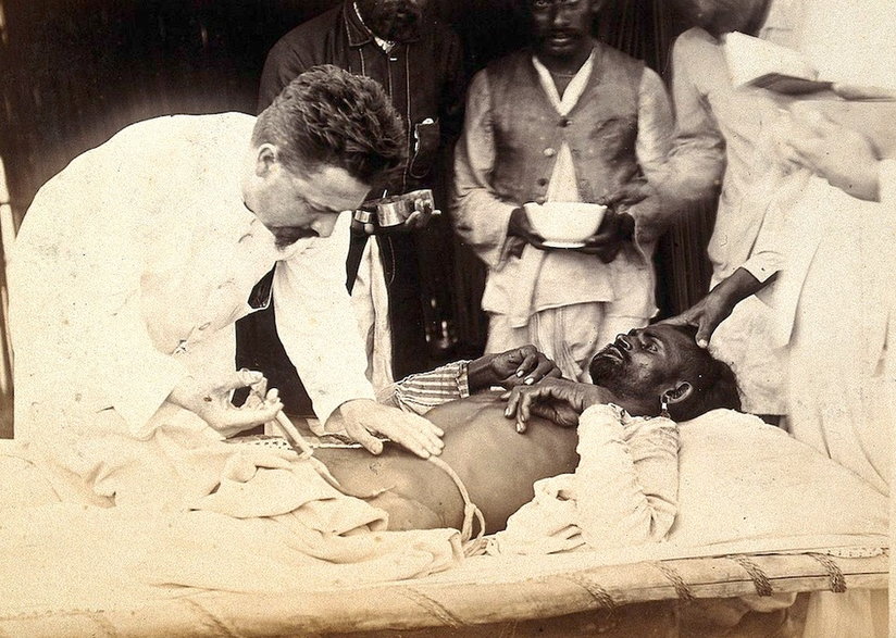 Leczenie pacjenta podczas epidemii dżumy w Indiach, 1897 r.