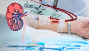 Bubrežni pacijenti u Srbiji bore se za terapiju i realnu šansu za transplantaciju