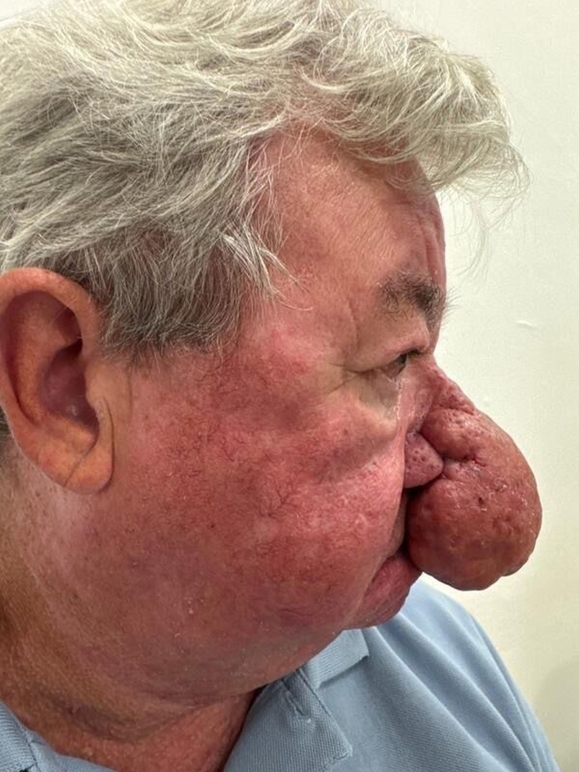 Gerardov obrovský nos mu znepríjemňoval život.