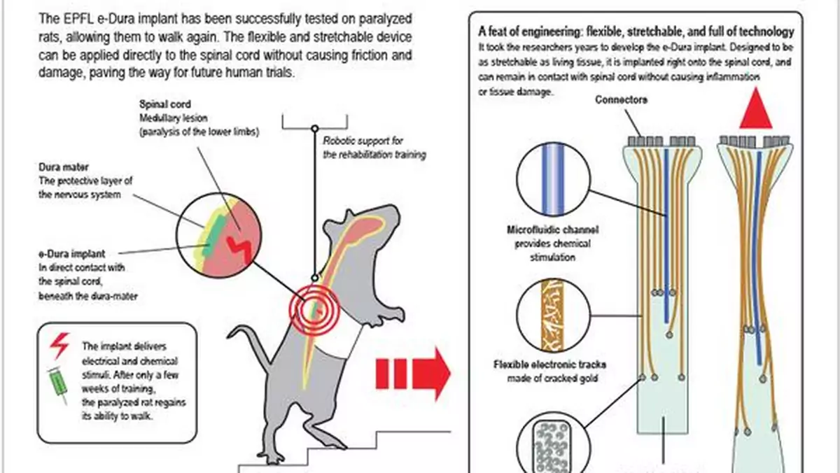 Neuroprotezy przywrócą sparaliżowanym pełną sprawność