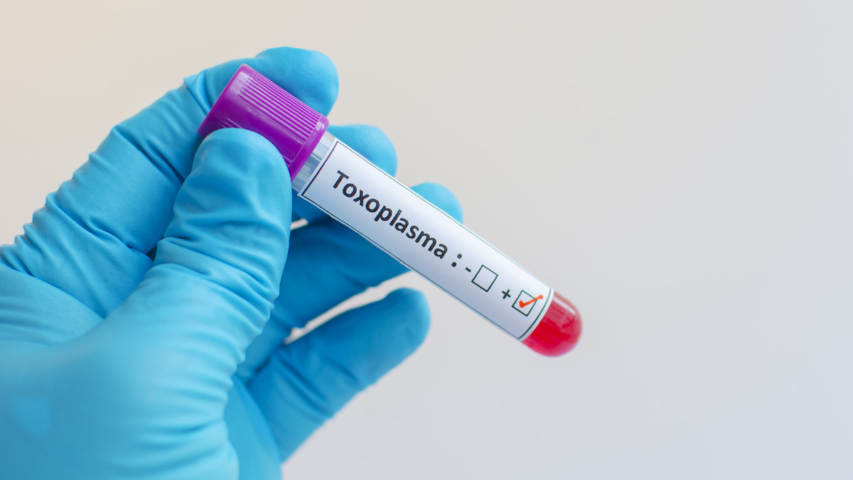 Toksoplazmoza: co to, objawy, źródło zakażeń, leczenie, ciąża