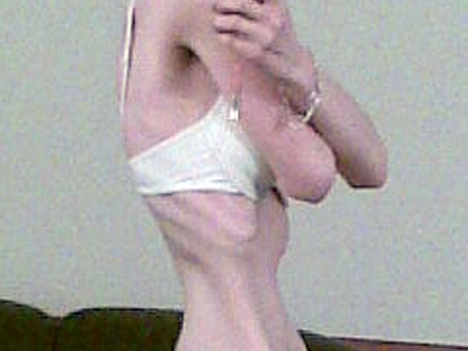 91023_ano-re-profimedia0240353607