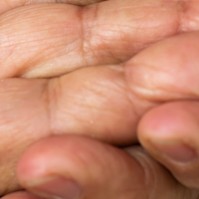 Mit tegyünk, ha a mamának eltűnt az ujjlenyomata? Vakcinainfó - Az orvos válaszol