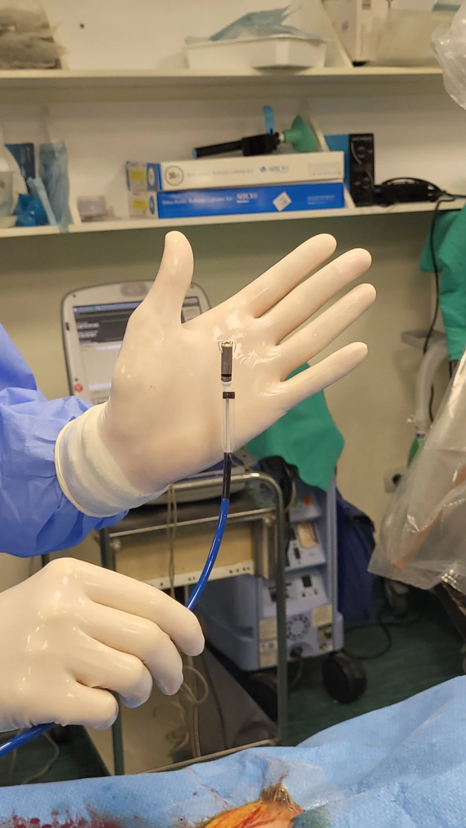 Najmanjeg pejsmejkera na svetu teži manje od dva grama i ima zapreminu od svega 0,8 kubika