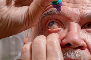 A helyes szemcseppentést pusztán a gyógyszer (csepp) kísérő iratából nem lehet kellően jól megtanulni. Sokaknak technikai bemutatás, sok próba, gyakorlás szükséges hozzá.